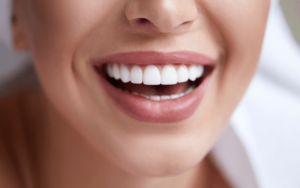 הלבנת שיניים - למי זה מתאים והאם כדאי לעשות