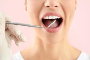רגישות אחרי הלבנת שיניים